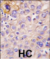 PERK (EIF2AK3) Antibody (Center)